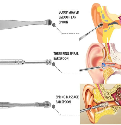 Ear Wax Remover, Premium Stainless Steel Ear Cleaning kit