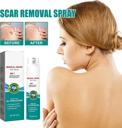 ScarRemove+ Advanced Spray Fade Scars