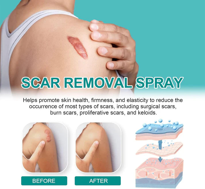 ScarRemove+ Advanced Spray Fade Scars